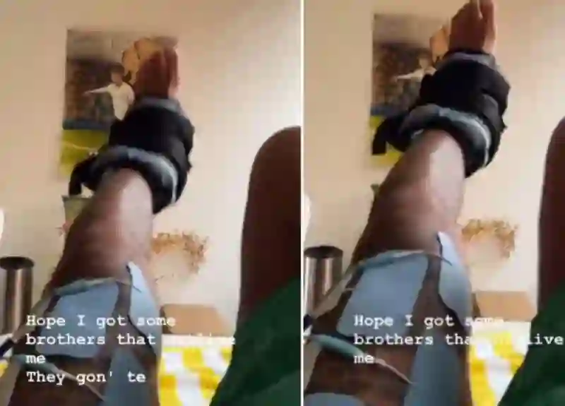 فيديو نيمار يمشي بطريقة غريبة بعد إصابته بقطع رباط صليبي 