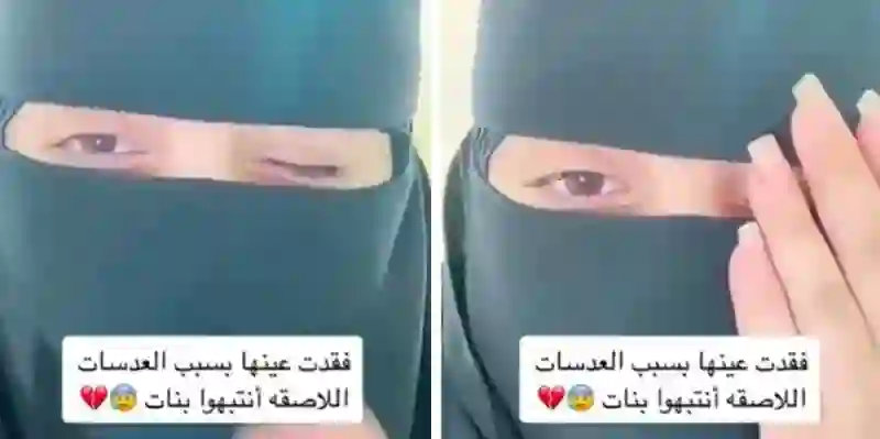 خطير: هذا النوع من العدسات اللاصقة المنتشر في السعودية يسبب تلف العين والعمى 